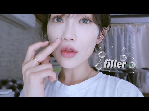 팔자주름, 코필러 후기❤️(feat. 코끝 수술후 필러, 추천or비추천, 주의할 점!)