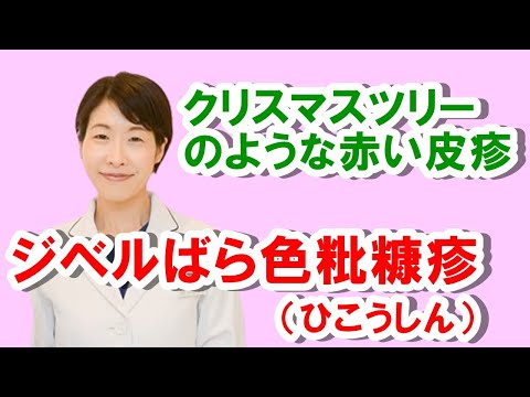 ジベルばら色粃糠疹 （ひこうしん）、赤い皮疹【公式 やまぐち呼吸器内科・皮膚科クリニック】