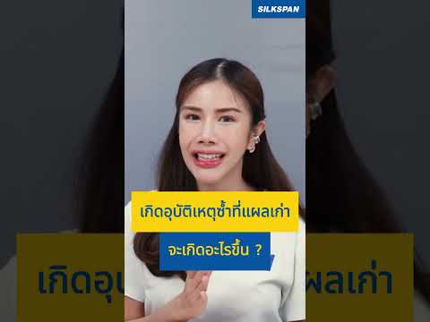 แผลเก่าของรถยนต์ สามารถ #เคลมประกัน ได้ไหม??