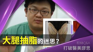 大腿抽脂迷思？ 打破醫美謬思 48-20171115