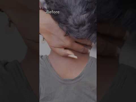 Neck darkness removal home remedy #shorts #youtube #darknecktreatment #darkneck #tanremove