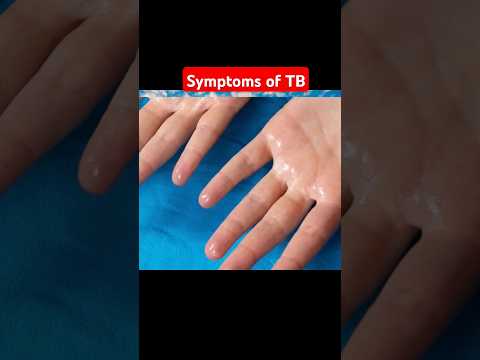 Symptoms if TB 2 #facts #health #doctor #drabbasofficial