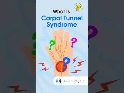 Carpal Tunnel Syndrome #physicaltherapy #physiotheraphy #carpaltunnelsyndrome #anatomy