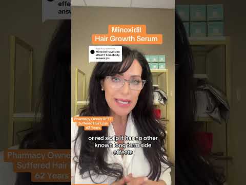 Does minoxidil have side effects? Minoxidil fair growth hairgrowth hair losshair loss remedy