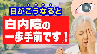 白内障寸前の人にだけ現れる症状と予防法