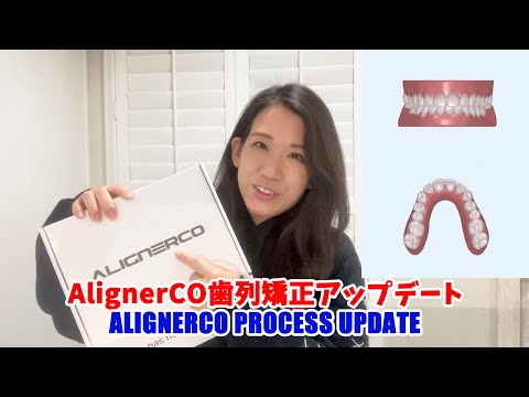 歯列矯正のアップデート　AlignerCo process update