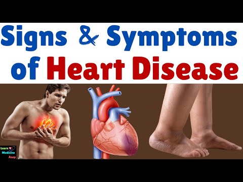 Signs and Symptoms of Heart Disease (Heart Failure)