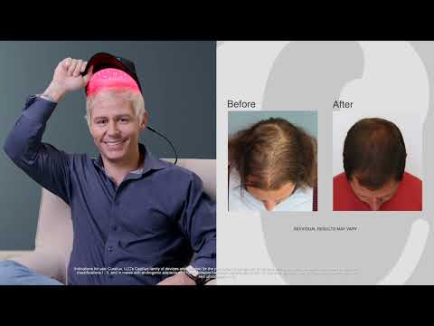 Hair loss no more: real men, real results with Capillus.