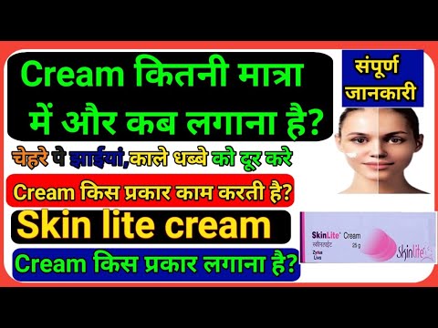 How to work skin lite Cream, cream किस प्रकार काम करती है?किस प्रकार लगाना है?cream कब और कितनी लगा