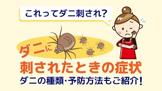 ダニ刺されの症状｜似たような虫刺されの特徴やダニの予防法をご紹介