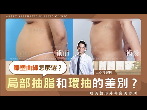 局部抽脂和環抽差別在哪裡？＃璞美＃王彥博醫師