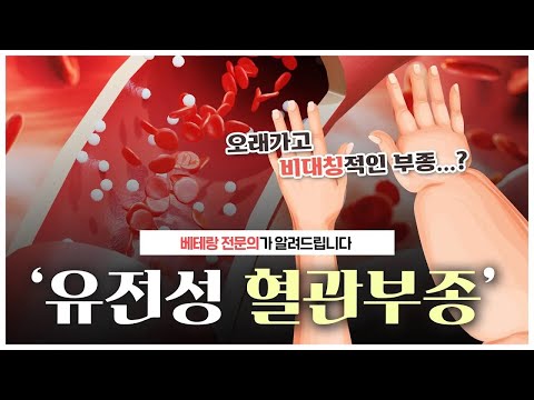 혈관때문에 심하게 붓는 희귀질환 '유전성 혈관부종'