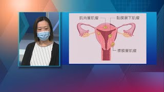 20200601【杏林在線】認識子宮肌瘤