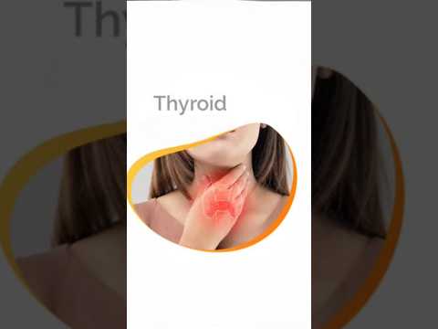 Thyroid (थायराइड ) का रामबाण इलाज | #shorts #shortvideo #thyroid #ytshorts #medicine #care