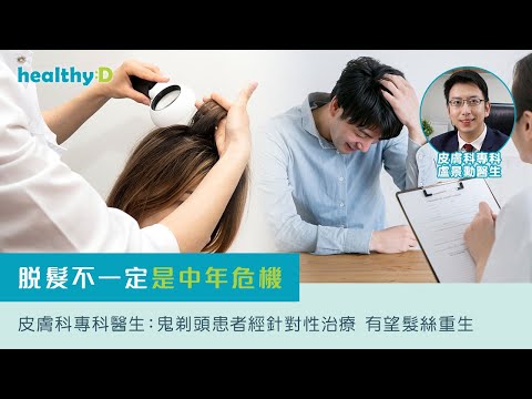 鬼剃頭(斑禿)｜未夠30歲就斑禿？免疫系統失衡「鬼剃頭」一發不可收拾？ 醫生：新一代藥物治療效果更理想