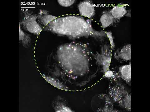 Unveiling lipid droplet dynamics, label-free