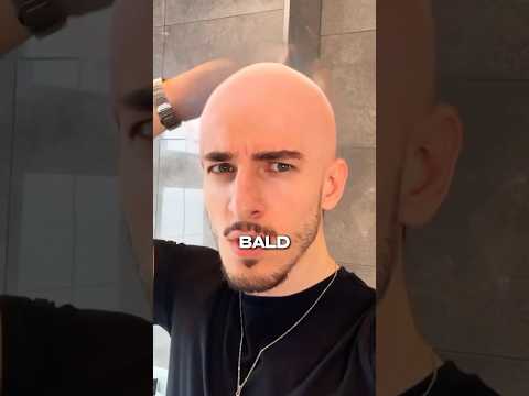 Why THIS Routine won’t Stop You From Balding 🤝👀