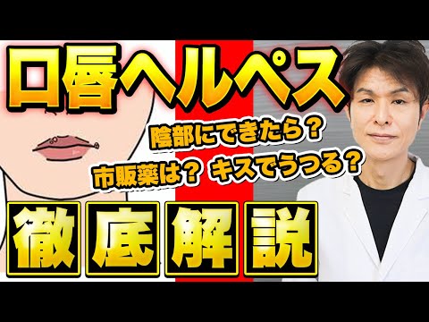 口唇ヘルペスの感染経路と予防策：症状と治療法を徹底解説