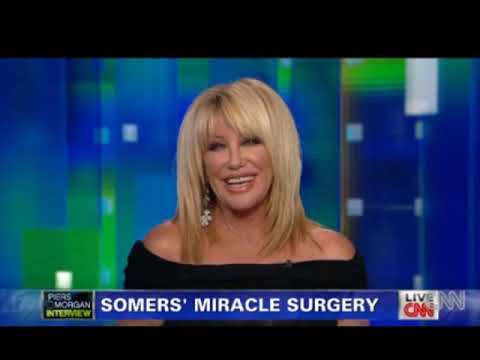 Piers Morgan & Suzanne Somers on Stem Cell Surgery