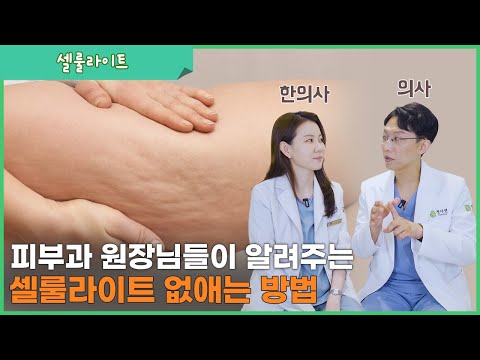 셀룰라이트 제거, 어떻게 치료할까요? (셀룰라이트의 원인과 종류)