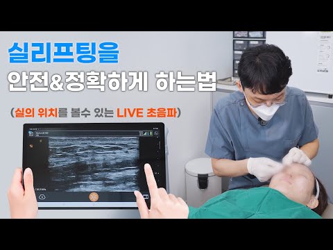 피부과 원장님이 직접 아내에게 실리프팅 해주기 (feat. LIVE로 초음파 실리프팅)