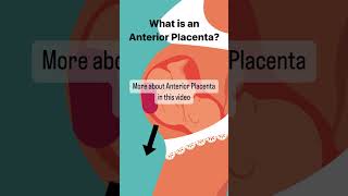 What is Anterior Placenta? #pregnant