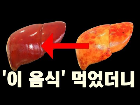 '이 음식들' 먹었더니 죽어가던 간이 살아났다. 간에좋은음식