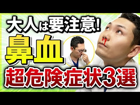 【絶対見逃すな！】　大人の鼻血の３つの危険症状を耳鼻科医が解説