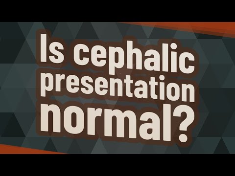 Is cephalic presentation normal?