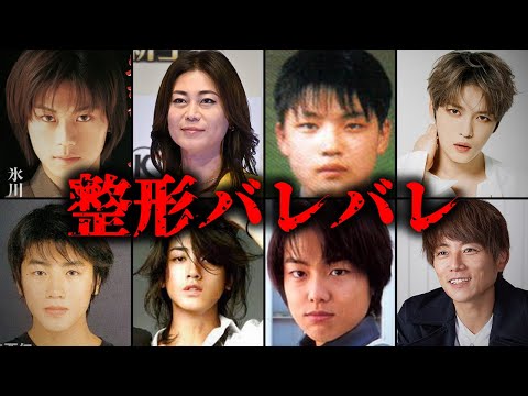 【バレバレ】整形をしている男性芸能人TOP10  パート2