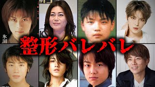 【バレバレ】整形をしている男性芸能人TOP10  パート2