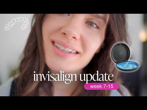 my invisalign experience: the things i didn't expect (part 3)