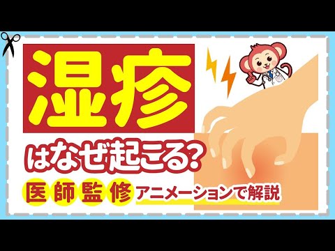 【湿疹】の原因と対処法