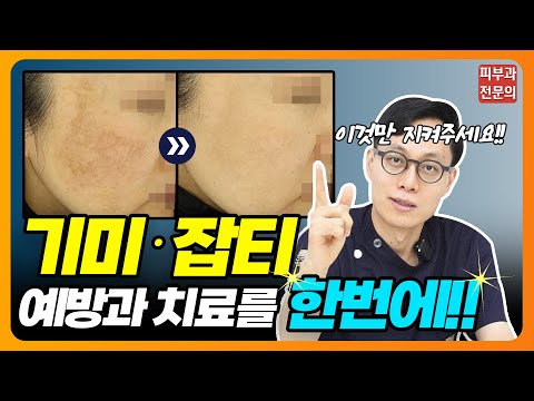 기미로 망한 내 피부 이렇게만 관리해주세요!! #기미잡티 #기미 #잡티