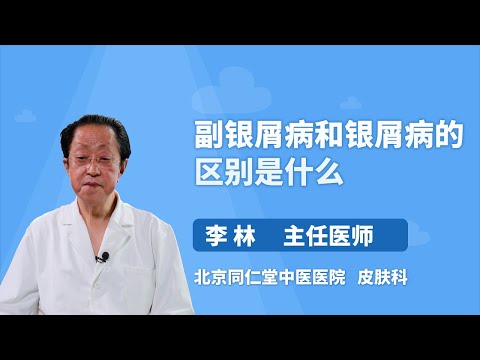 副银屑病和银屑病的区别是什么 李林 北京同仁堂中医医院