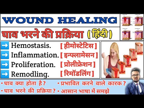 Wound Healing | Wound Healing Pathology | Wound Healing Process | Step of Wound Healing | Pathology