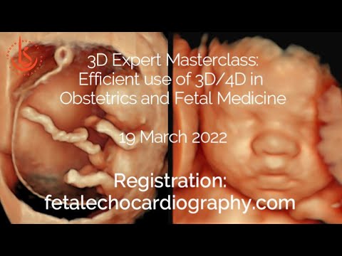 3D Expert Masterclass: Efficient use of 3D/4D in Obstetrics and Fetal Medicine