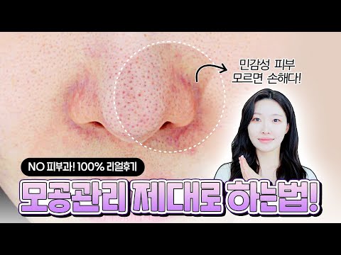 cc) 민감성피부는 빨리 늙는다.. 모공없애는 진짜 방법, 원인공개..🤩모공줄이는방법!(+이벤트🎁)ㅣ아랑