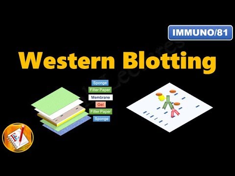 Western Blotting (Immunoblotting) : Principle and Complete Procedure Explained ! (FL-Immuno/81)