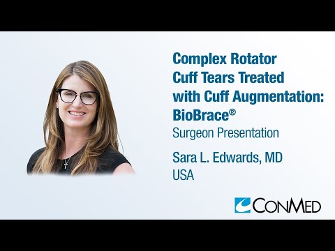 Dr. Sara Edwards - PRESENTATION (2023): Complex Rotator Cuff Tears Treated with Cuff Augmentation