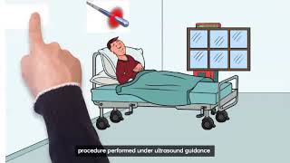 EVLA procedure