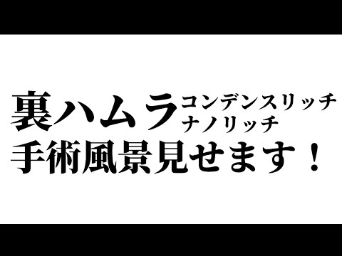 裏ハムラ+コンデンスリッチ+ナノリッチ手術見せます！