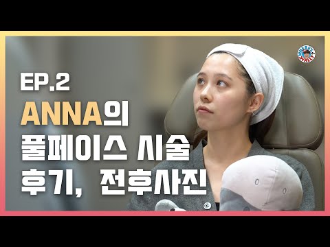 ANNA의 첫 한국 피부과시술  Ep 2.  이마필러, 턱필러,  팔자필러, 코필러 , 입술필러 전 후 공개 !