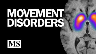 Movement Disorders