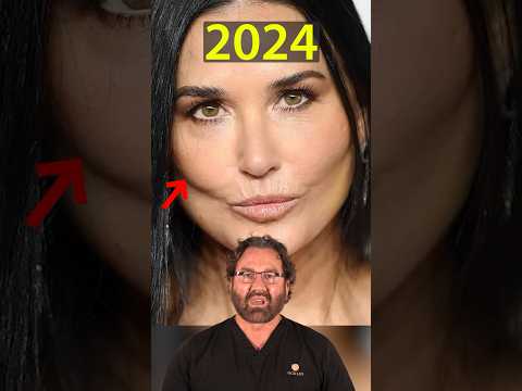 Demi Moore’s New Face (2024) | Plastic Surgeon Reacts