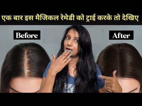 एक बार इस मैजिकल रेमेडी को ट्राई करके तो देखिए|natural scalp scrub for Fast Hair Growth