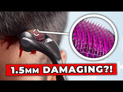 Microneedling: The BEST Needle Size For Hair Regrowth (2024 Update)