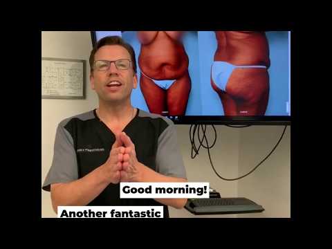 Abdominoplasty with an umbilical hernia repair. Watch now!