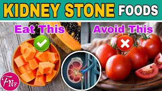 ✅ Kidney Stone Diet:- 17 Foods to Eat and 14 Foods to Avoid