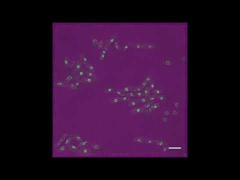 Nuclear membrane protein Lem2 regulates nuclear size through membrane flow